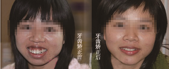 C:\Users\Administrator\Desktop\1_100822094511_1.jpg