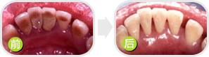 牙齿松动能造成口臭吗