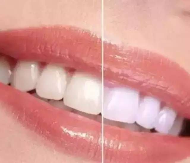ô