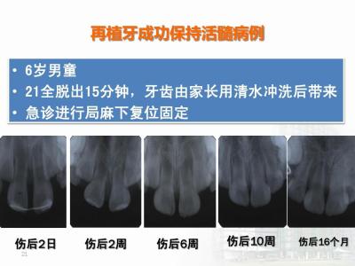 u=2886865050,3747585502&fm=21&gp=0.jpg