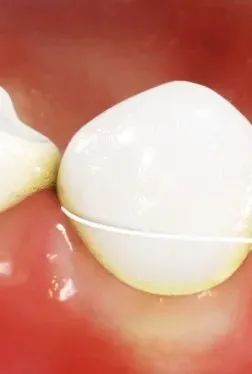 ͼƬ