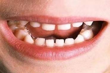 ͼƬ