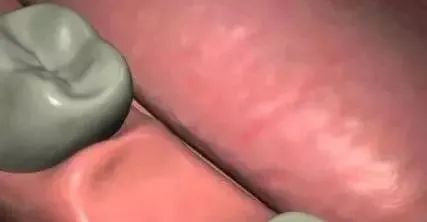 ͼƬ